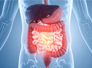 irrigation du côlon Manche